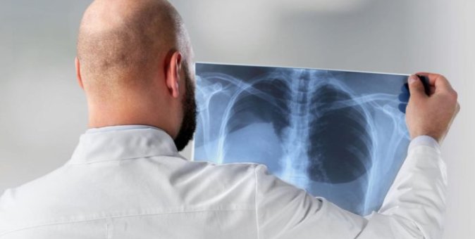 Promieniowanie rentgenowskie – kiedy i jak zostało odkryte?