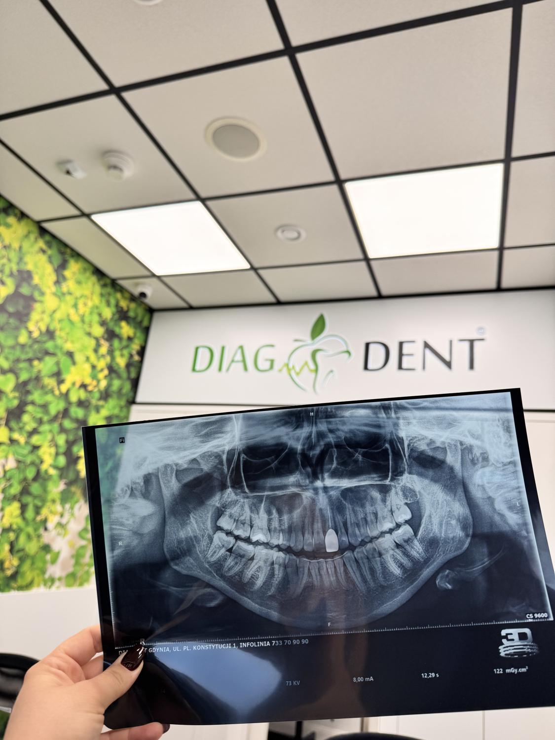 Pantomogram na tradycyjnej kliszy