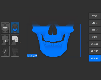 Tomografia szczęki i żuchwy 16x10 cm